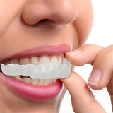 Snap-On Smile Veneers