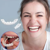 Snap-On Smile Veneers