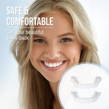 Snap-On Smile Veneers
