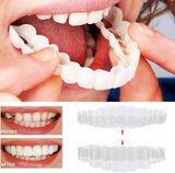 Snap-On Smile Veneers