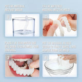 Snap-On Smile Veneers