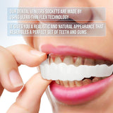 Snap-On Smile Veneers
