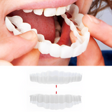 Snap-On Smile Veneers