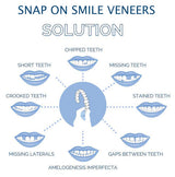 Snap-On Smile Veneers